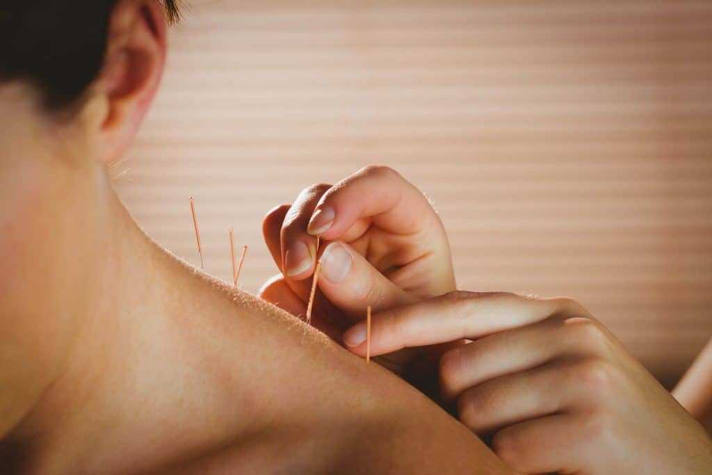 acupunctuur-tan-balance acupunctuur-tan-balance